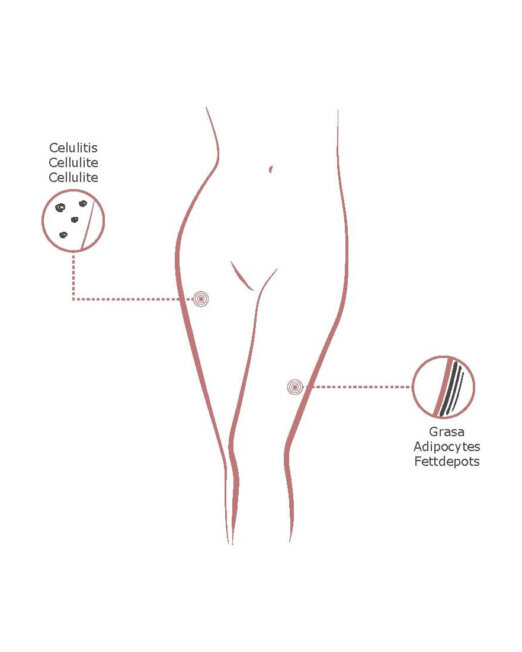 cellulite-pack-2